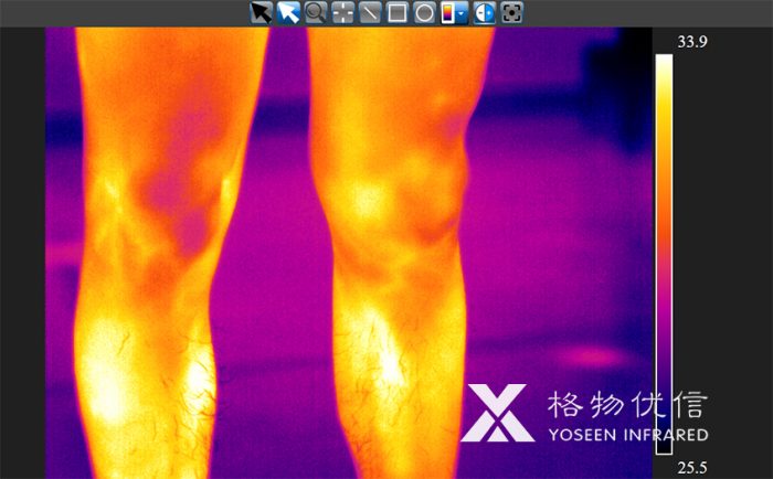 使用格物优信红外热像仪拍摄的老板的腿毛红外热像图