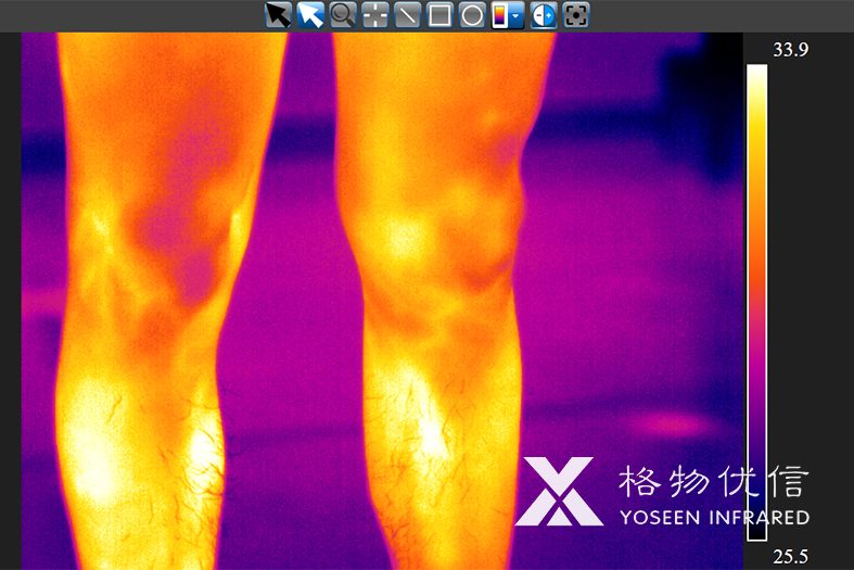 使用格物优信红外热像仪拍摄的老板的腿毛红外热像图